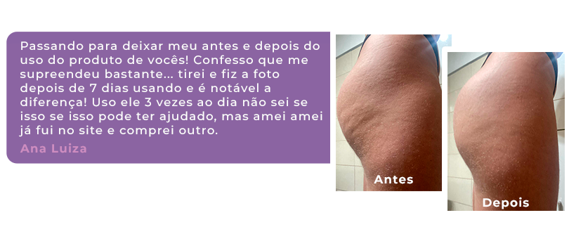 ANTES E DEPOIS - ana luiza